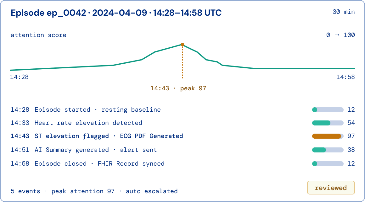 An episode timeline showing an attention score rising to a peak of 97, with timestamped events from episode start through detection, summary and record sync